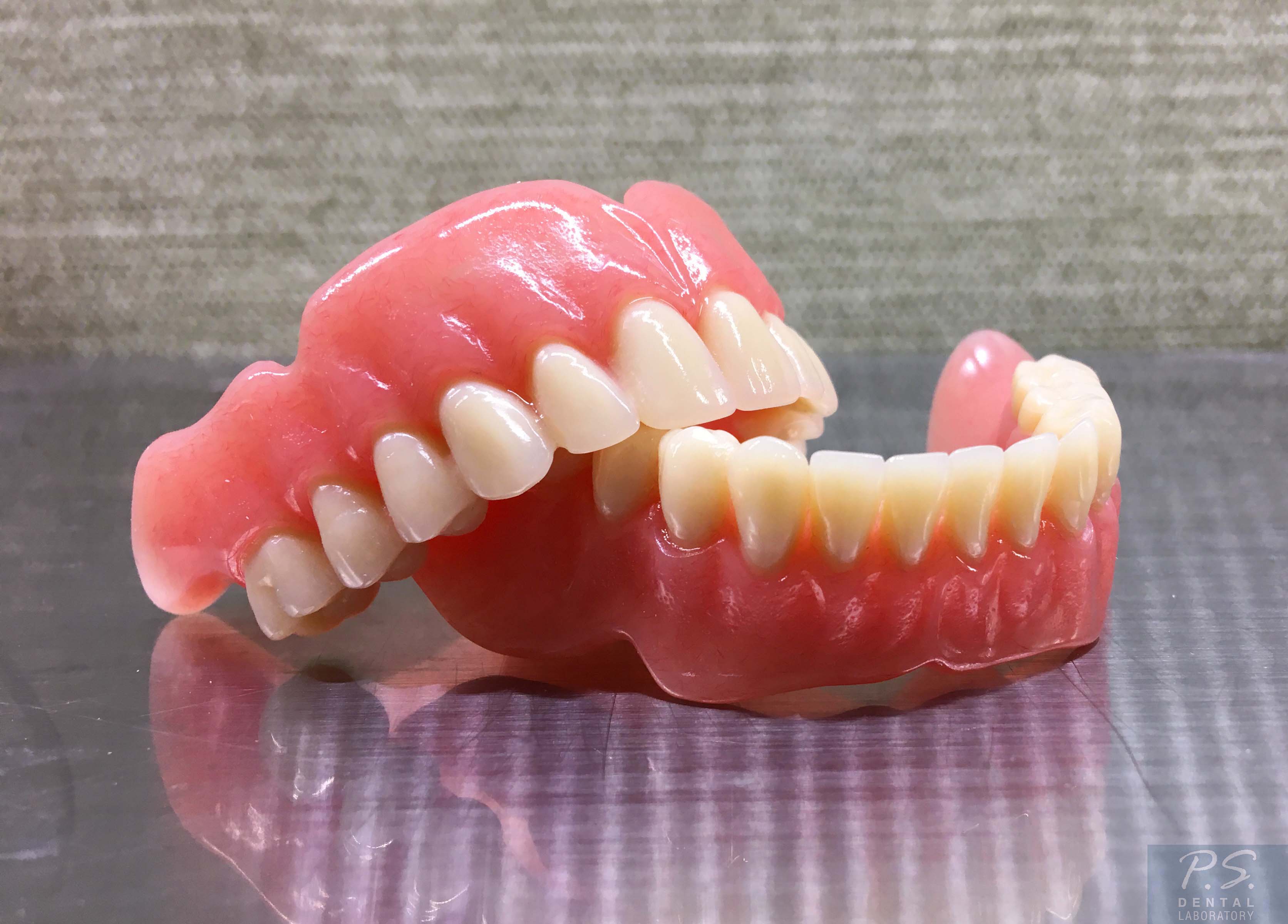 Съемный протез зубов какие бывают. Полные съемные зубные протезы.