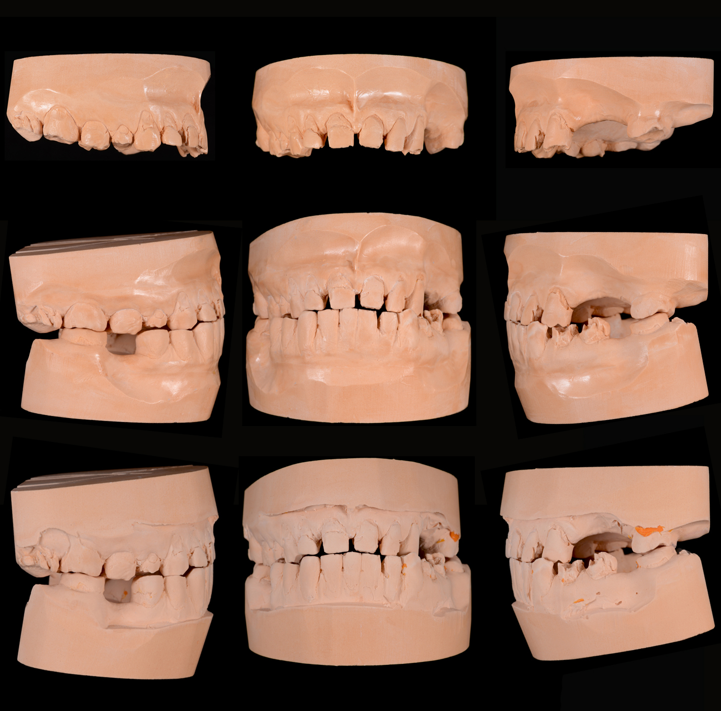 Протокол создания диагностической модели в P.S. Dental 