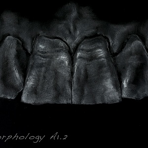 Проект "Shade of morphology"